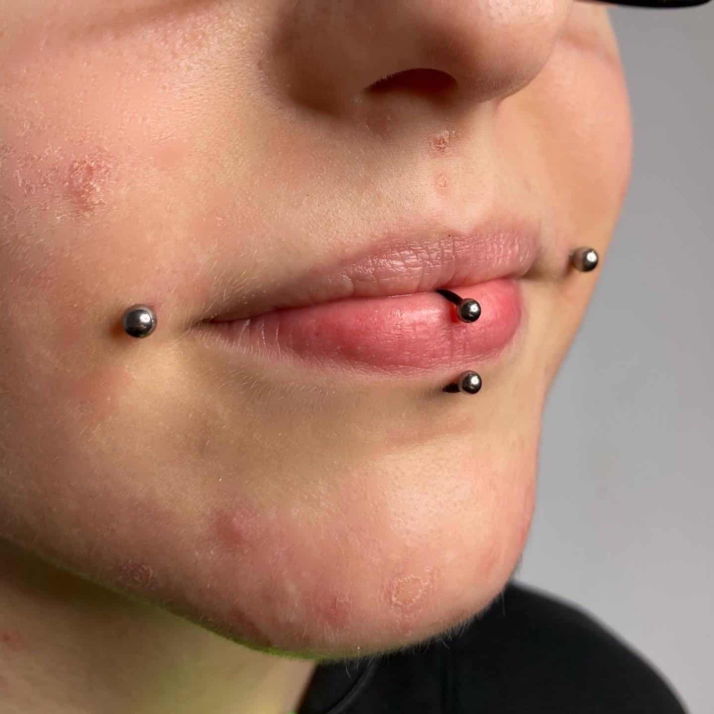 7sinstattoo.live Zbliżenie dolnej połowy twarzy osoby pokazujące wiele piercingów: dwa po każdej stronie dolnej wargi i jeden przez środek. Skóra, zaczerwieniona i naznaczona trądzikiem, sugeruje surową autentyczność uchwyconą idealnie przez 18D4BBCA-BA10-41E0-AD8A-0DDB0080262D. Najlepsze studio tatuażu Seven Sins Tattoo