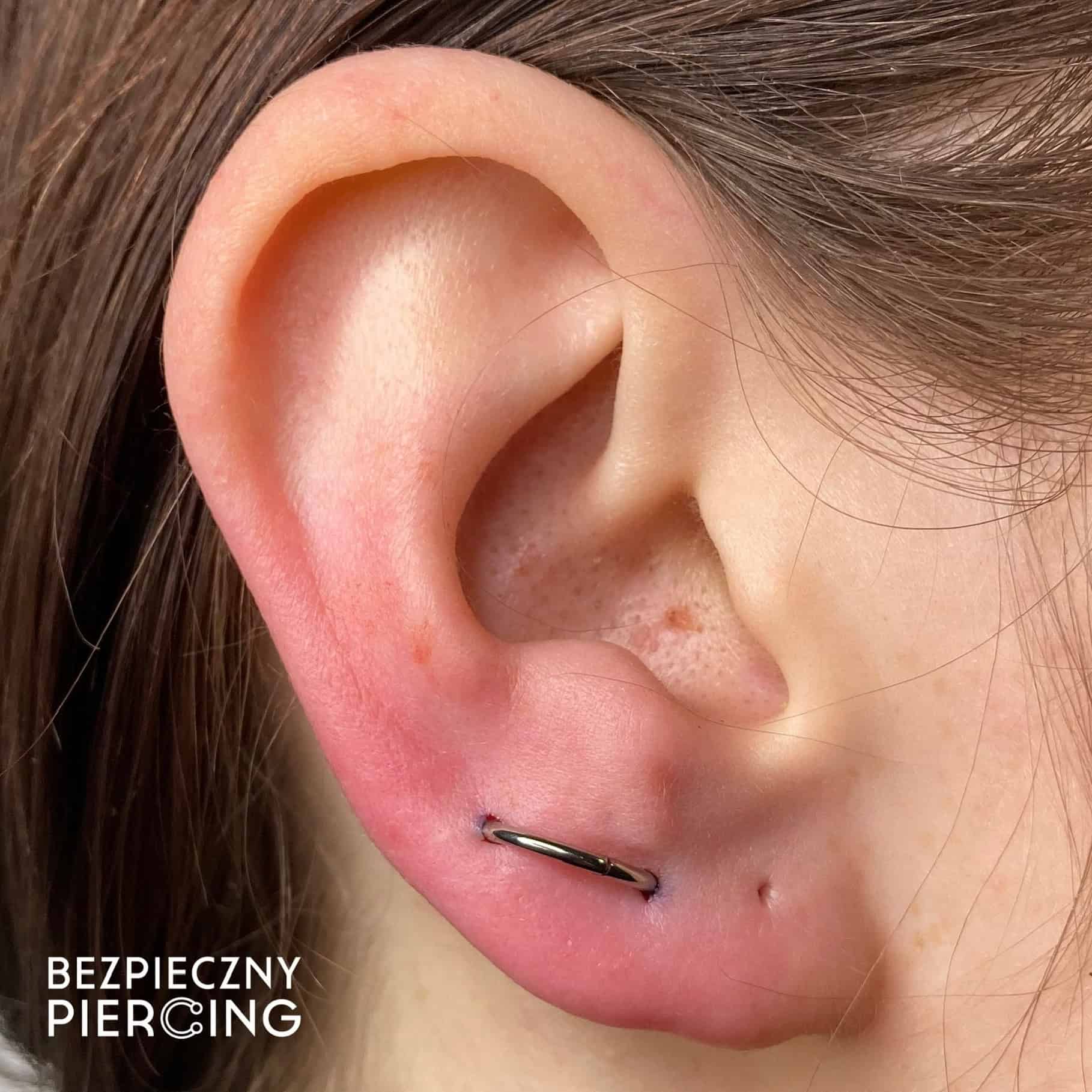 7sinstattoo.live Zbliżenie ucha ze świeżym piercingiem na dolnej chrząstce, z małym metalowym kółkiem. Skóra wokół piercingu jest lekko zaczerwieniona i opuchnięta, co wskazuje, że piercing jest nowy. Słowa „F65A0EEC-6499-4E83-A4C0-8388D84DA657” są widoczne w lewym dolnym rogu, podkreślając pochodzenie ze studia tatuaży Poznań. Najlepsze studio tatuażu Seven Sins Tattoo