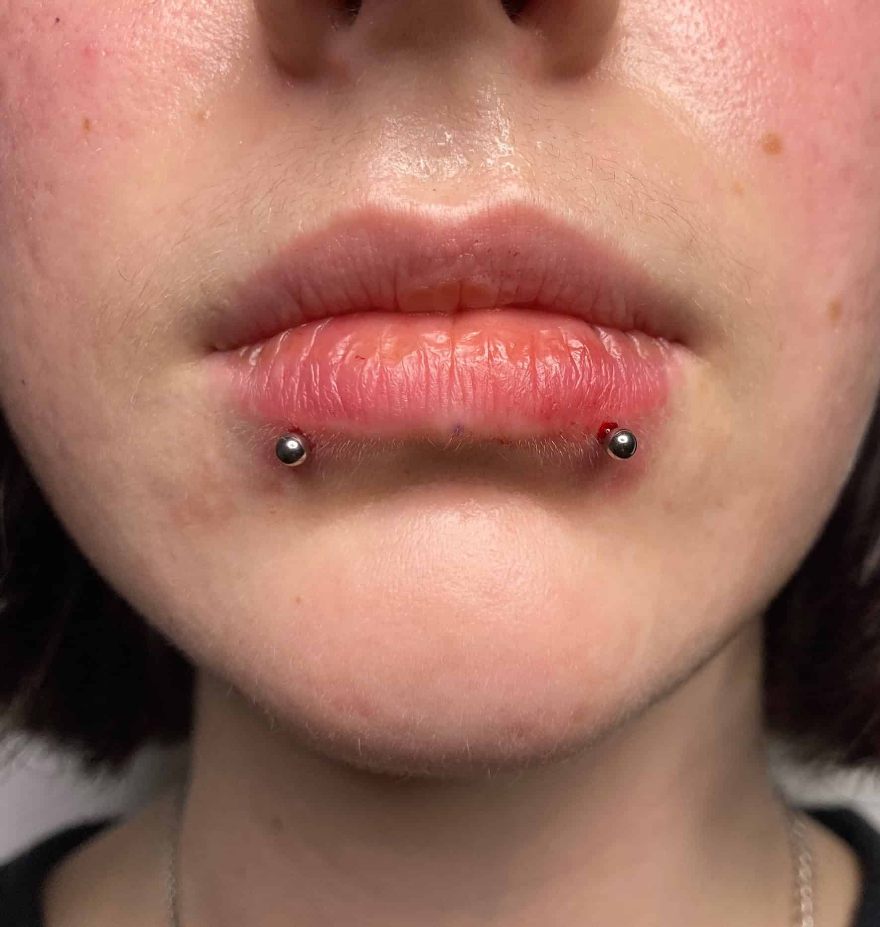 7sinstattoo.live Zbliżenie ust osoby z dwoma świeżymi piercingami po bokach dolnej wargi, każdy ozdobiony małymi, okrągłymi, metalowymi ćwiekami. Skóra wokół przekłutych miejsc wydaje się lekko czerwona. Uchwycono w IMG_2056 w najlepszym studiu tatuażu Poznań, na neutralnym i nieostrym tle. Najlepsze studio tatuażu Seven Sins Tattoo