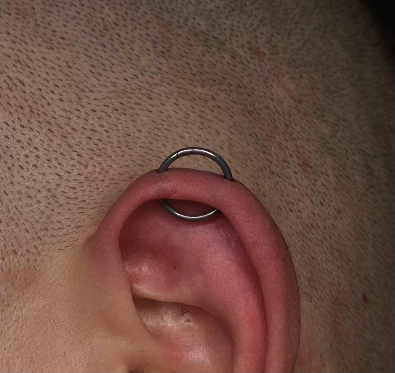 7sinstattoo.live Zbliżenie ucha osoby z małym, srebrnym kółkiem przebitym przez górną chrząstkę, wykonane w najlepszym studio tatuażu w Poznaniu. Ucho jest lekko zaczerwienione wokół miejsca przekłucia, a tło pokazuje dokładnie ogoloną lub łysą głowę. Nazwa produktu: IMG_5683. Najlepsze studio tatuażu Seven Sins Tattoo